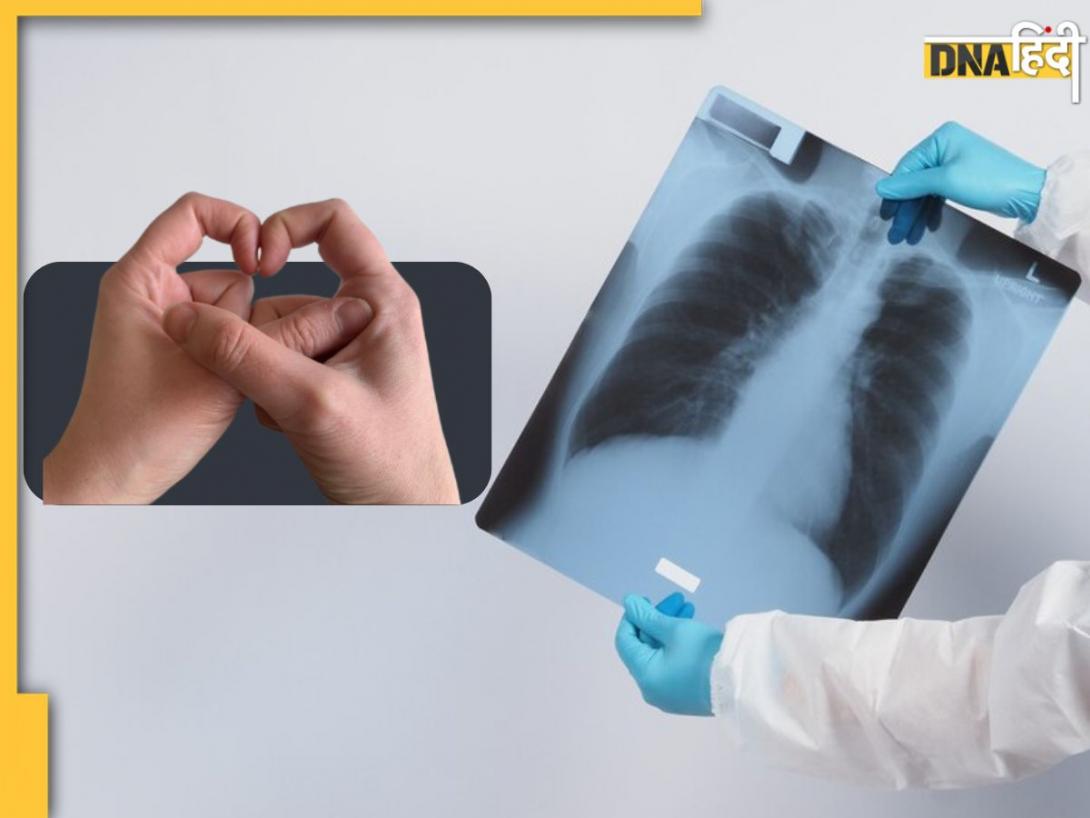 क्या है Diamond Finger Test? जानें कैसे इस आसान टेस्ट से घर बैठे लगा सकते हैं Lungs Cancer का पता