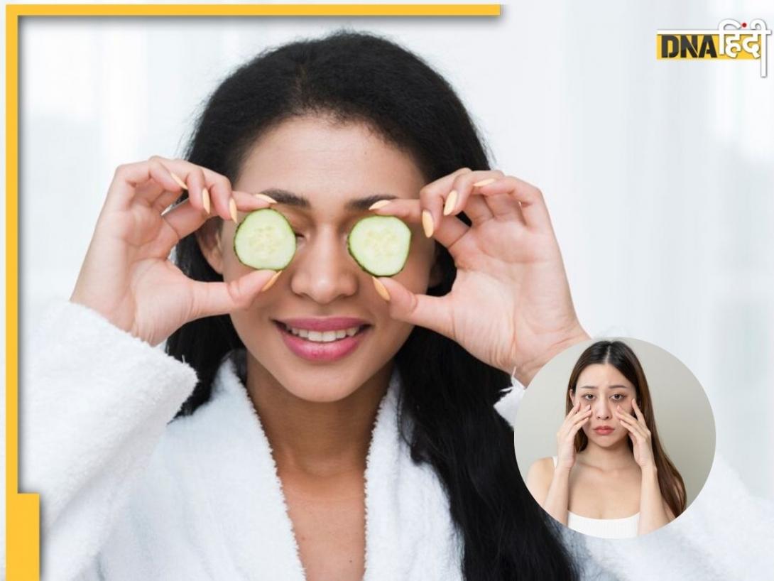 Dark Circles Removal Tips: जिद्दी डार्क सर्कल्स को दूर कर देंगे ये 5 टिप्स, पहले इस्तेमाल से ही दिखेगा असर