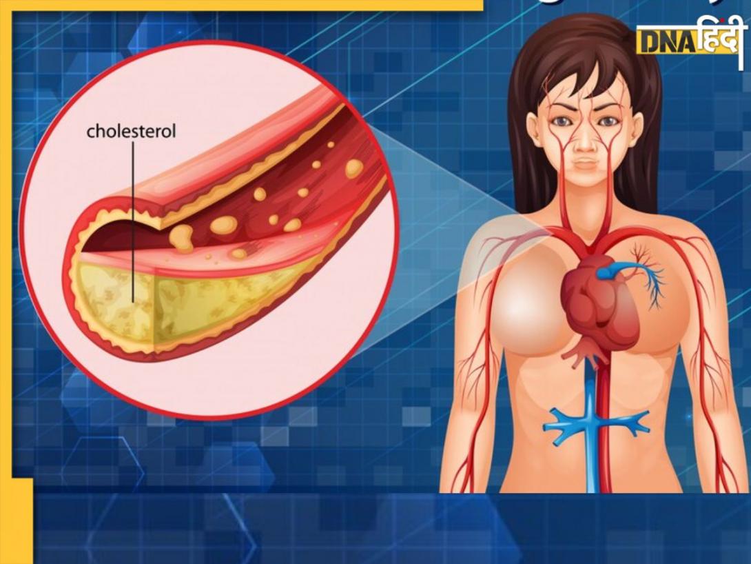 बिना दवा के शरीर से निकल जाएगा सारा गंदा Cholesterol, बस अपना लें ये आदतें