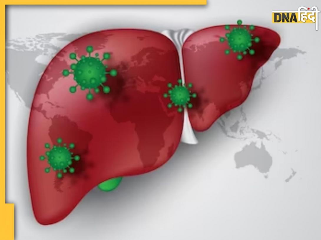 Liver Cancer का कारण बन सकता है डायबिटीज और हाई कोलेस्ट्रॉल, तुरंत अपनाएं बचाव के ये उपाय