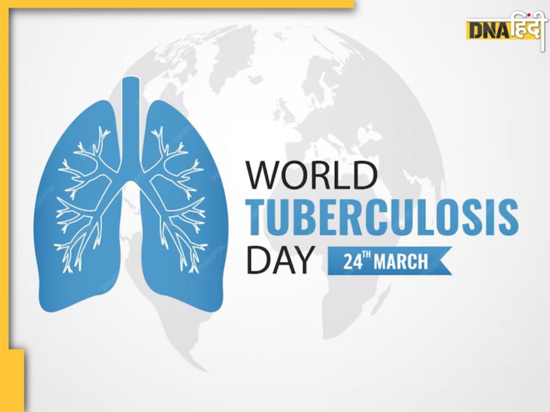 World Tuberculosis Day 2025: कैसे फैलता है TB रोग? जानें इसके लक्षण से लेकर बचाव के उपाय