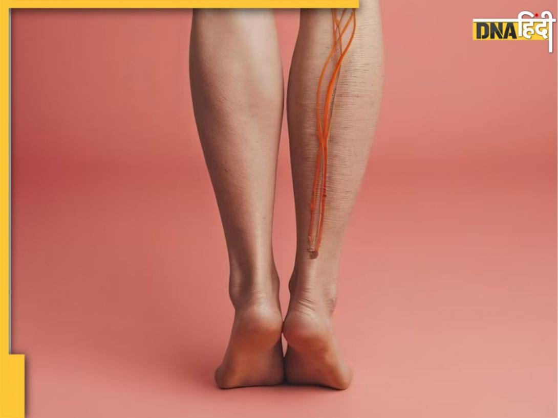 Leg Nerve Blockage: पैर की नसें हो रही हैं ब्लॉक? शरीर में दिखने वाले ये लक्षण देते हैं संकेत, तुरंत दें ध्यान
