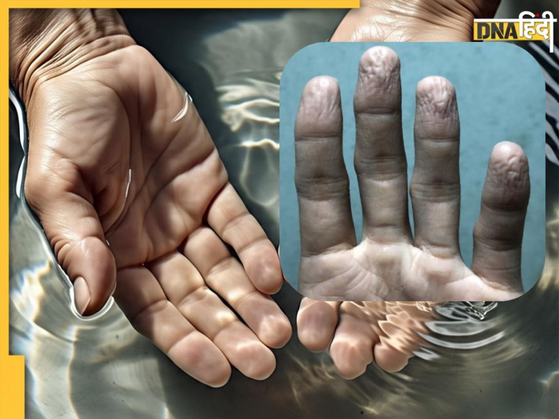 Wrinkled Skin In Water: क्यों पानी में ज्यादा देर तक रहने पर सिकुड़ जाती है हाथ-पैर की स्किन?