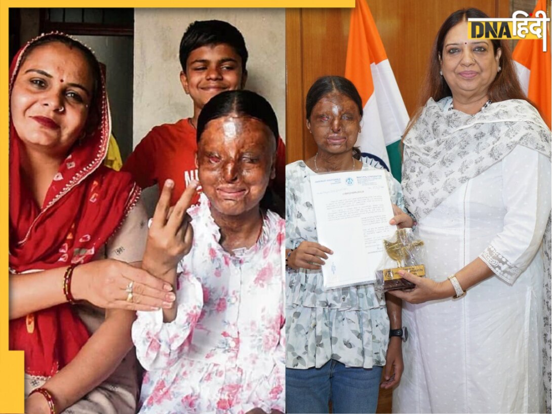 एसिड अटैक से चली गई थी आंखों की रोशनी, पिता हैं चपरासी, अब CBSE बोर्ड से लाईं 95.6% मार्क्स