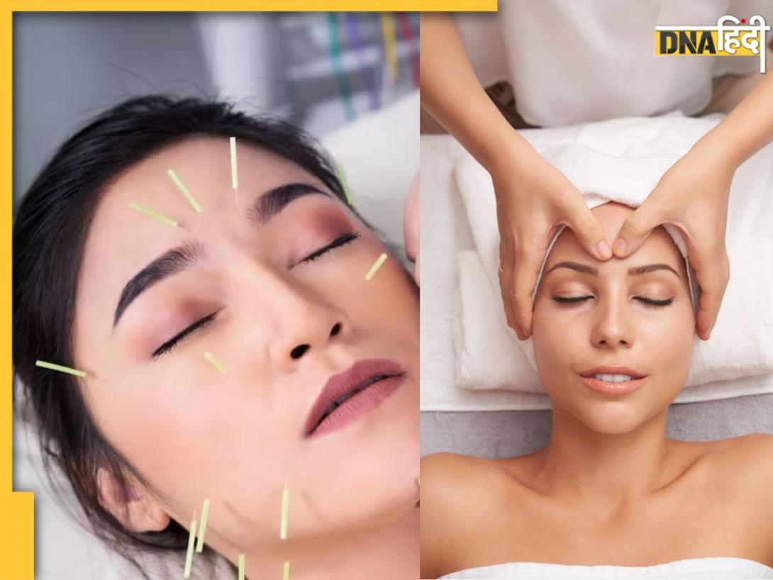 क्या है Facial Acupuncture, जिससे थम जाती है उम्र, देखने में दर्दनाक लेकिन असरदार है ये तरीका