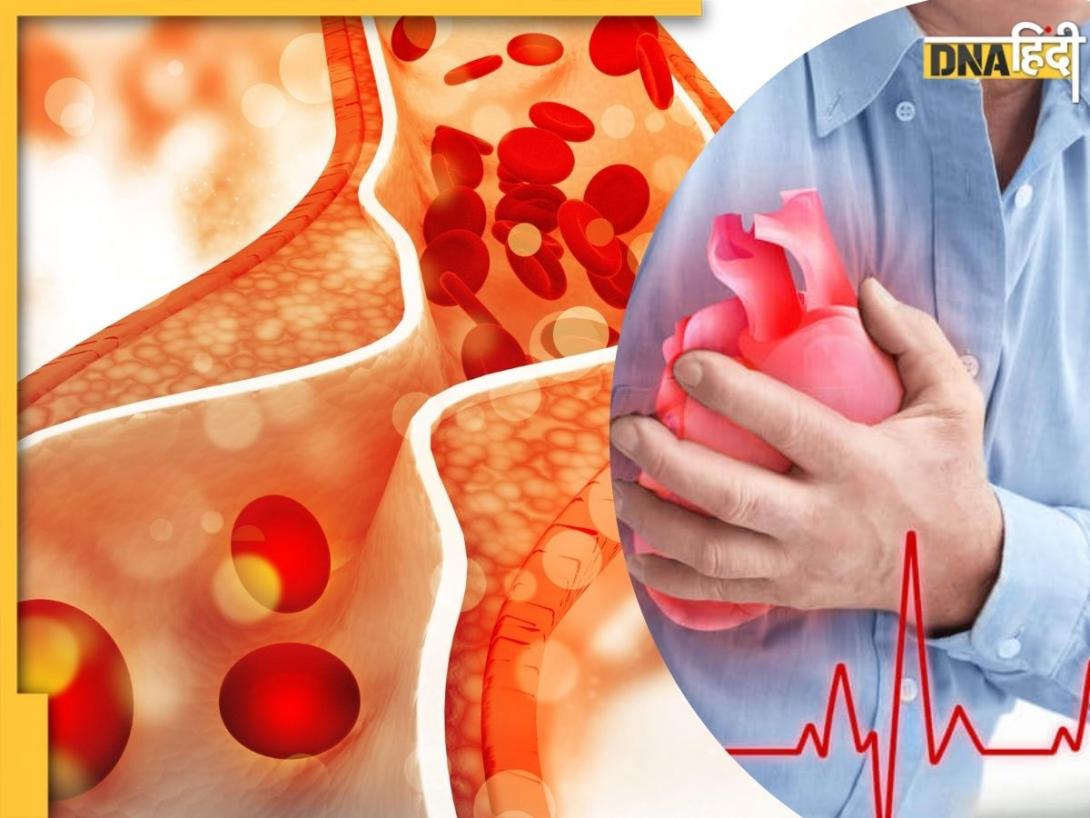 Bad Cholesterol: बैड कोलेस्ट्रॉल को कम करेंगी ये 5 आदतें, आज ही करें इनमें बदलाव