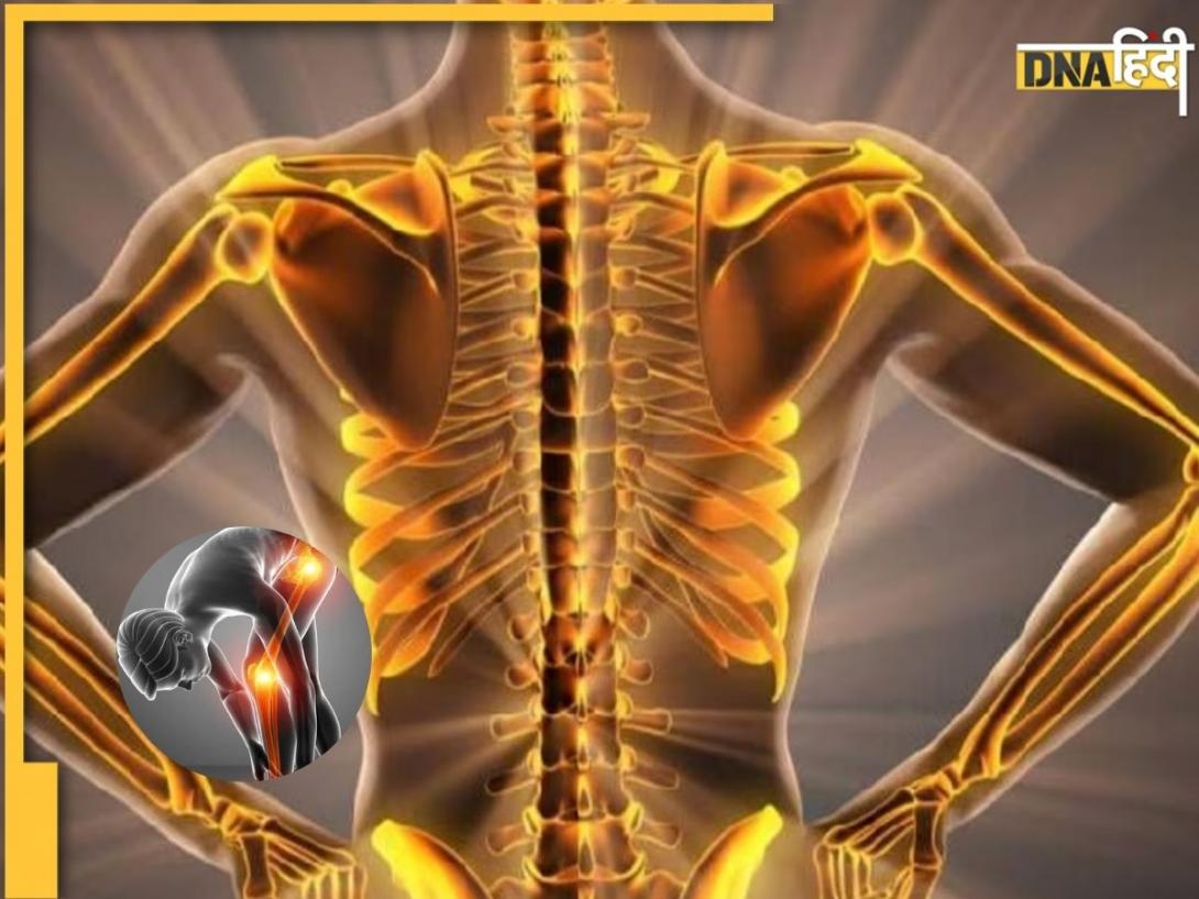 Strong Bones: कमजोर हड्डियों को लोहा बना देंगे ये 5 फूड्स, शरीर को मिलेगी फौलादी ताकत