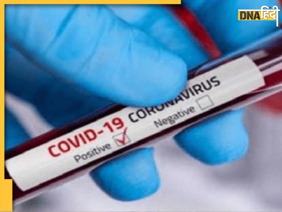 Covid-19 Case Update: नोएडा-गाजियाबाद में भी पहुंचा कोरोना, दिल्ली-NCR में बढ़े केस, जान लें कोविड अटैक का ये पहला लक्षण