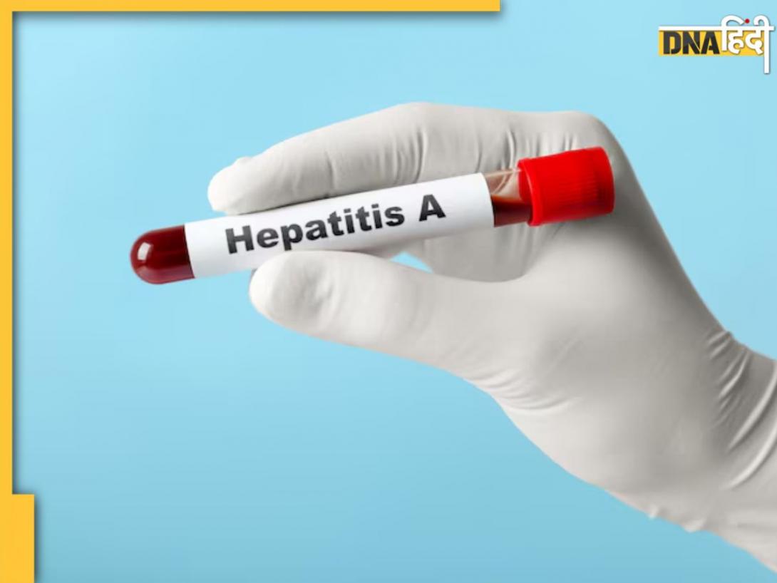 क्या हैं Hepatitis-A के लक्षण? कोरोना के बाद तेजी से बढ़ रही ये बीमारी