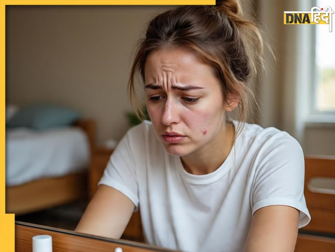 इन 5 Skin care हैक्स से करें चेहरे और पीठ के जिद्दी मुहांसों का खात्मा, मिलेगी चमकदार और बेदाग त्वचा 