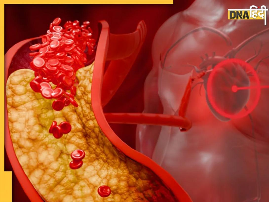 हार्ट हेल्थ को हरा-भरा रखेंगे ये 5 हरे पत्ते, साफ होगा नसों में जमा Bad Cholesterol