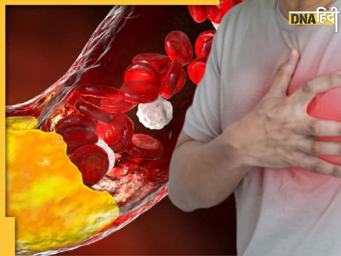 नाश्ते में की गई गलतियों से बढ़ जाता है Bad Cholesterol, हार्ट अटैक का बन सकता है कारण
