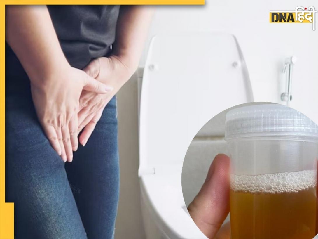 Foamy Urine Remedy: टॉयलेट में झाग आ रहा है तो हो सकते हैं ये कारण, जाने कैसे दूर होगी समस्या?
