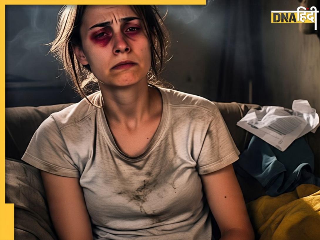 Dark Circles Remedies: बिना महंगे ट्रीटमेंट के डार्क सर्कल्स से पाएं छुटकारा, बस अपने रुटीन में शामिल करें ये चीजें