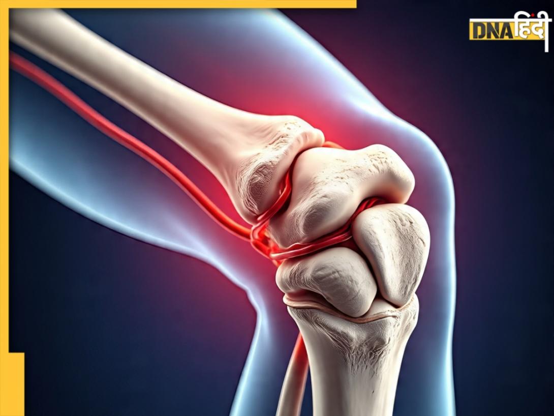 Diet For Joints: जोड़ों में रहता है भयंकर दर्द, कमोजर हो रही हैं हड्डियां? जानें कैसे होनी चाहिए डाइट