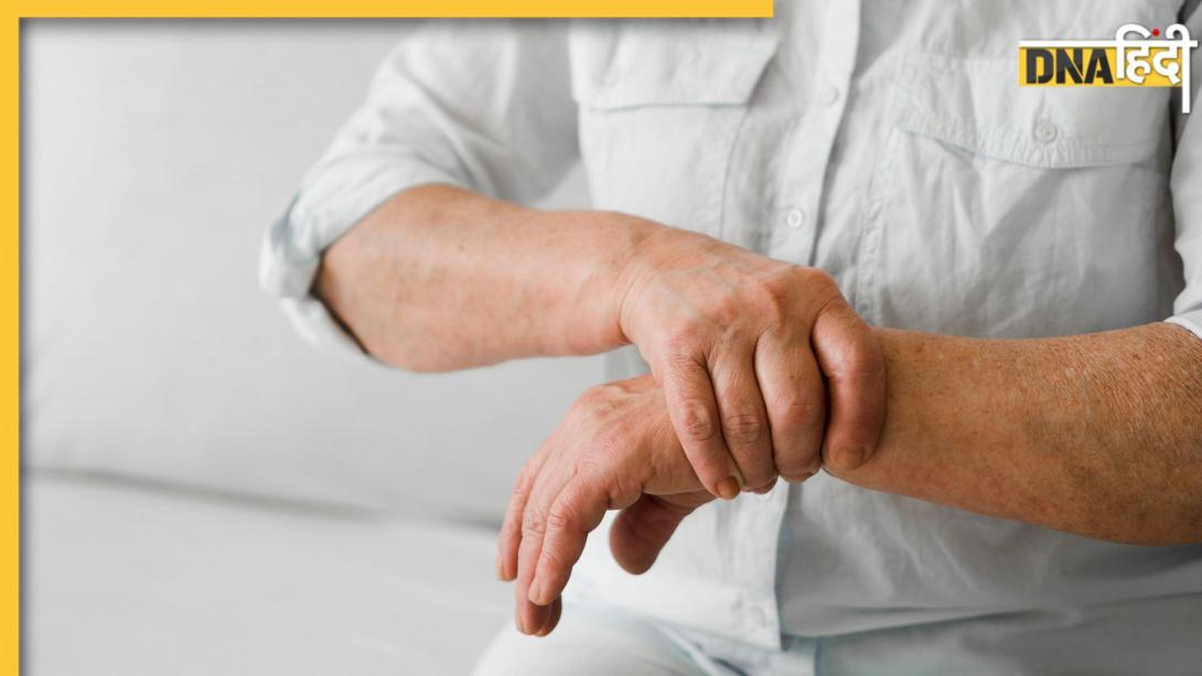 Uric Acid Problem: यूरिक एसिड से परेशान तो फॉलो करें ये 5 रूल्स, पेशाब के जरिए निकल जाएगी सारी गंदगी