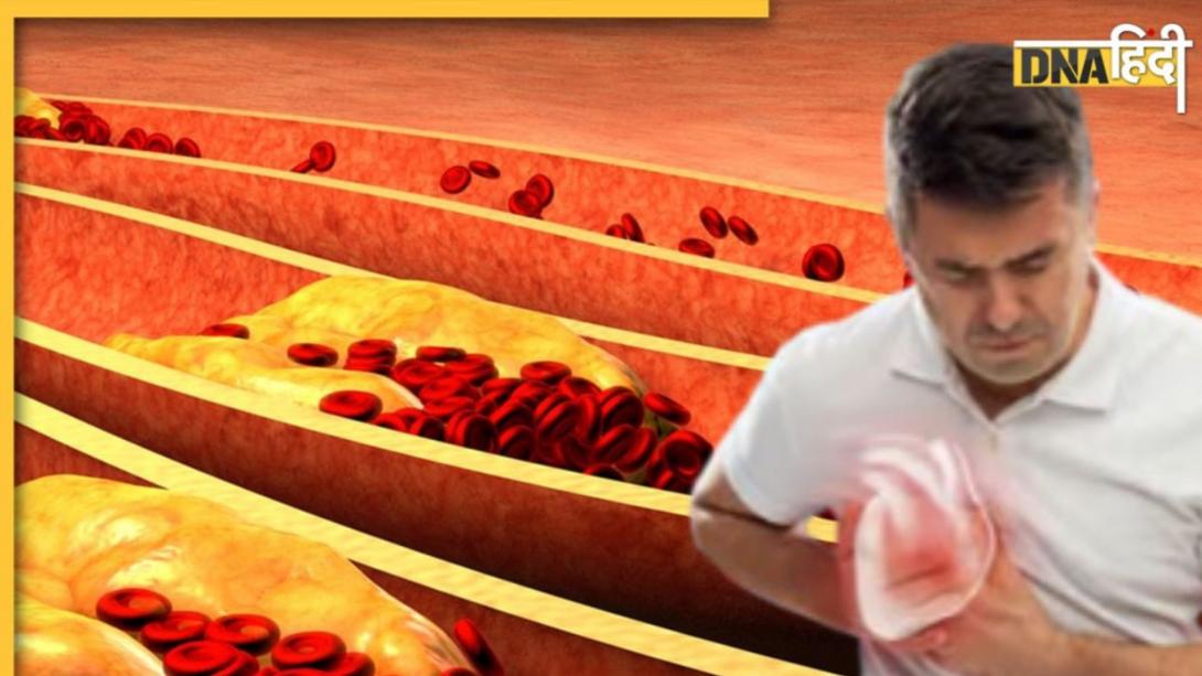 नसों में जमा गंदगी को वैक्यूम क्लीनर की तरह साफ कर देंगे ये 5 फूड्स, Bad Cholesterol का होगा सफाया