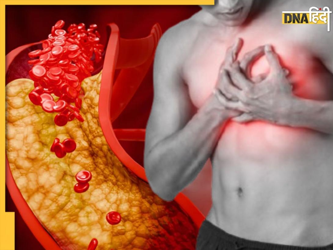 Bad Cholesterol को कम करेंगी ये 2 देसी ड्रिंक्स, नसों की ब्लॉकेज हो जाएगी साफ