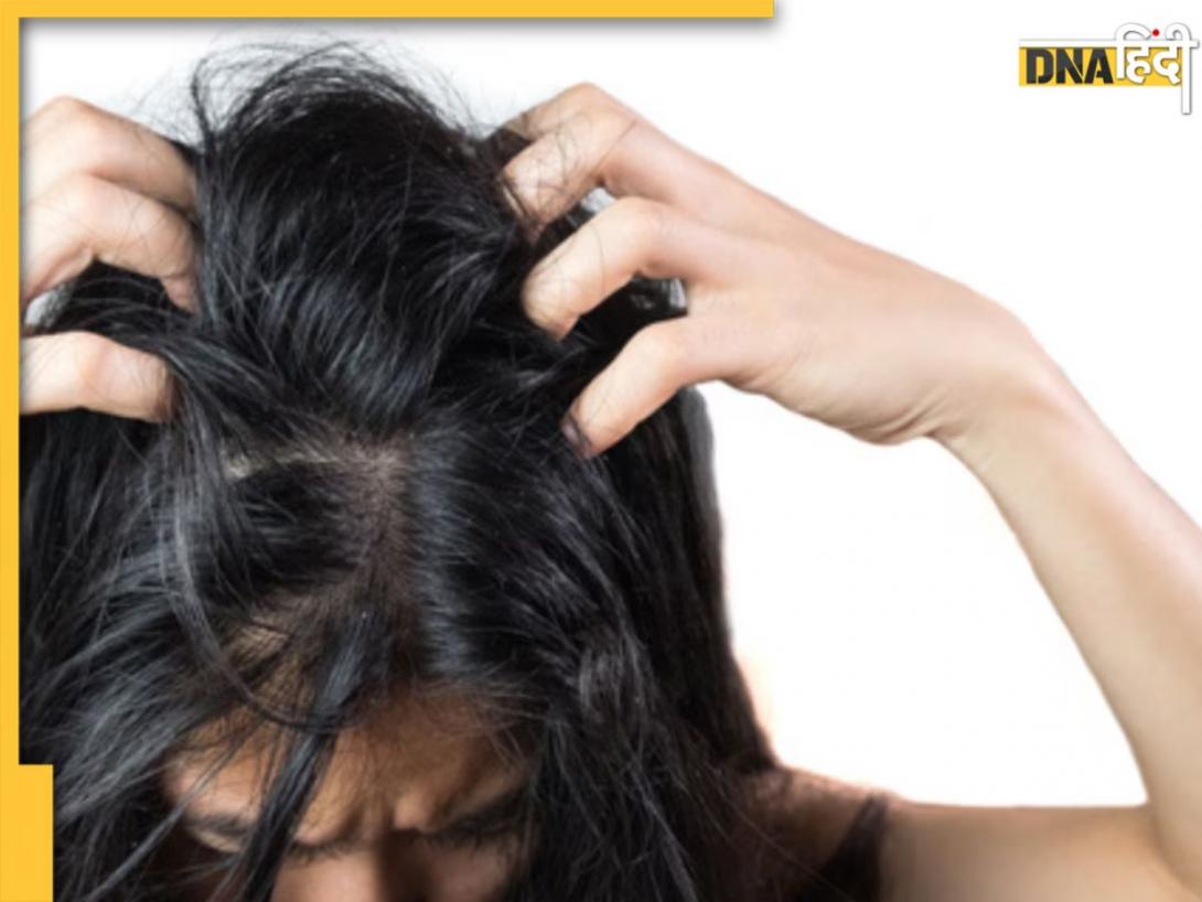 Monsoon Hair Care: बारिश में भीगने से चिपचिपे हो गए हैं बाल, खुजली करने लगी है परेशान तो इन उपायों से करें समाधान