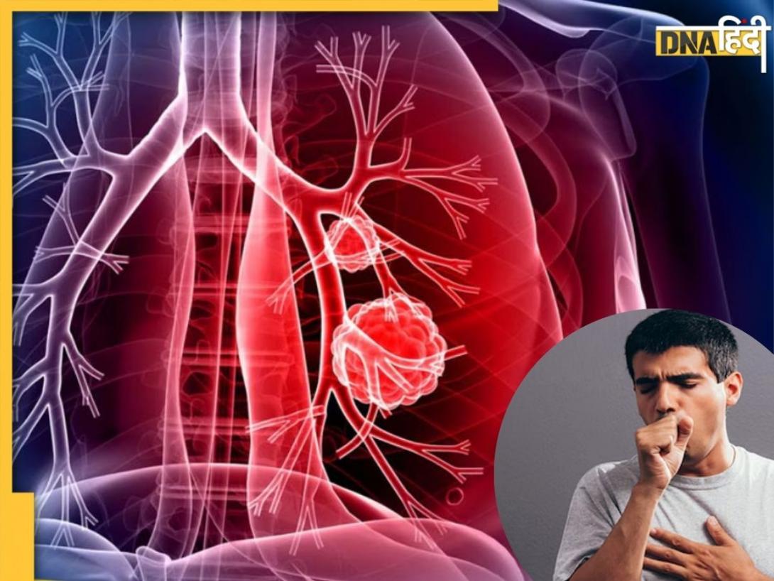World Lung Cancer Day 2025: आज है वर्ल्ड लंग्स कैंसर डे, यहां जानें फेफड़ों में कैंसर के बढ़ते मामलों के बीच कैसे रहें सुरक्षित?