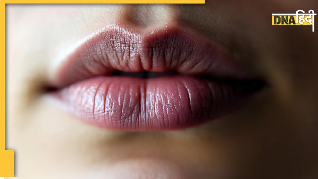 Dark Lips Remedy: स्मोकिंग ही नहीं, शरीर में इन पोषक तत्वों की कमी से भी हो जाते हैं होंठ काले  