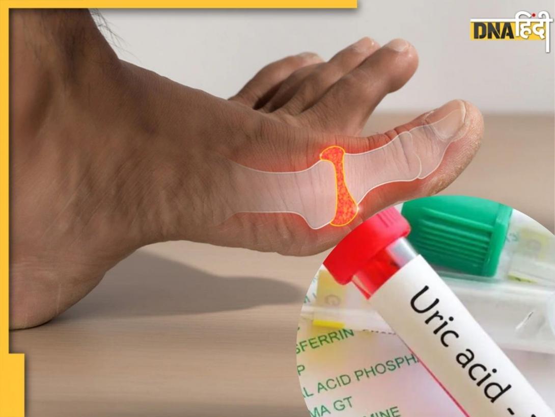 Uric Acid कम करने के लिए खाएं इन हरी पत्तियों से बनी स्वादिष्ट चटनी, दूर होगी दर्द और सूजन की समस्या