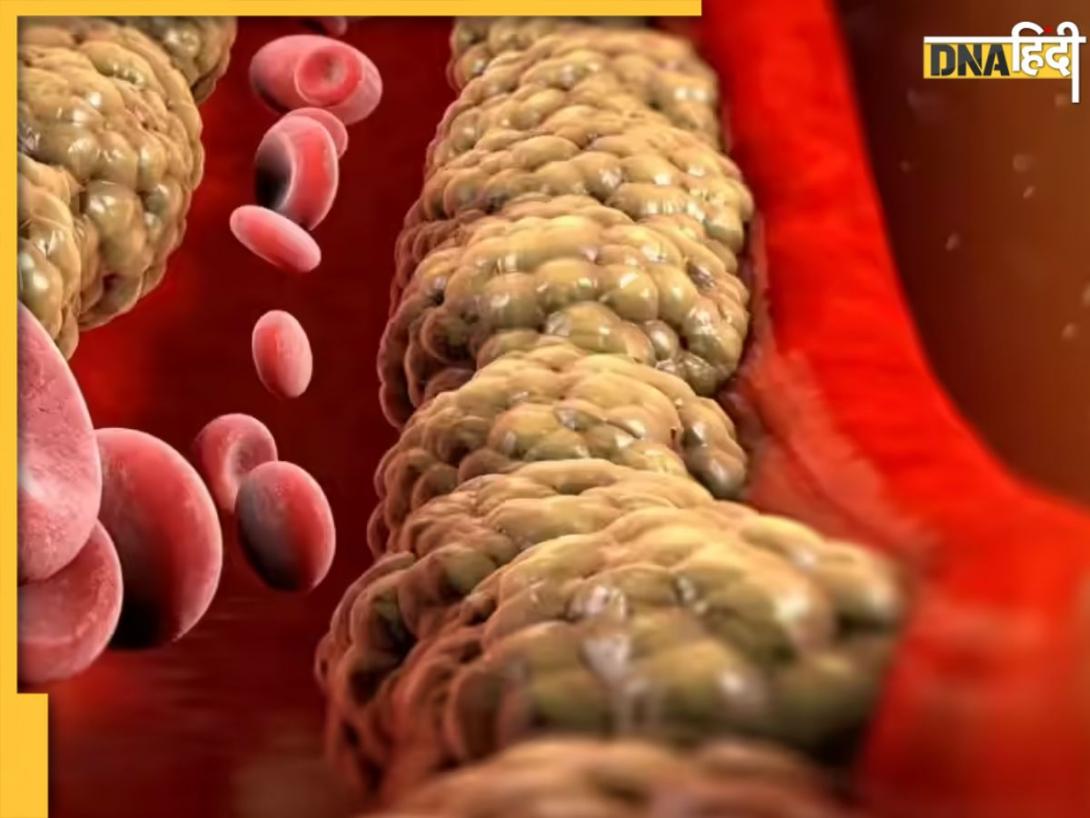 Bad Cholesterol: कोलेस्ट्रॉल कंट्रोल के लिए खाएं ये सफेद चीज, हेल्दी रहेगा हार्ट, मिलेंगे और भी कई फायदे