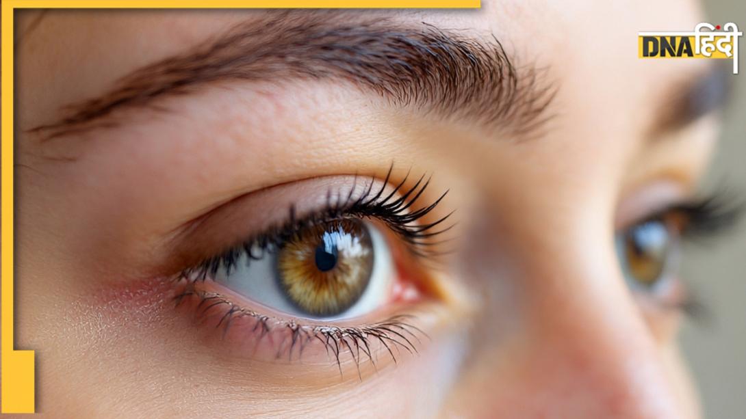 Cholesterol Signs In Eyes: आंखें खोल देंगी शरीर में कोलेस्‍ट्रॉल बढ़ने का राज, ये लक्षण दिखते ही हो जाएं सावधान
