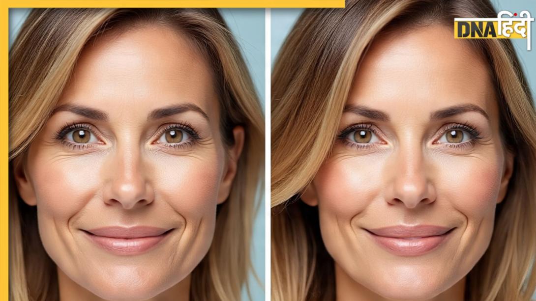 Anti Aging Remedies: कम उम्र में ही नजर आने लगी हैं झुर्रियां तो इन तरीकों से रोकें एजिंग का असर, टाइट रहेगी स्किन