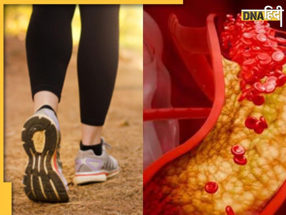 High Cholesterol Signs: चलते वक्त नजर आते हैं हाई कोलेस्ट्रॉल के ये 5 लक्षण, नजर आते ही भागें डॉक्टर के पास