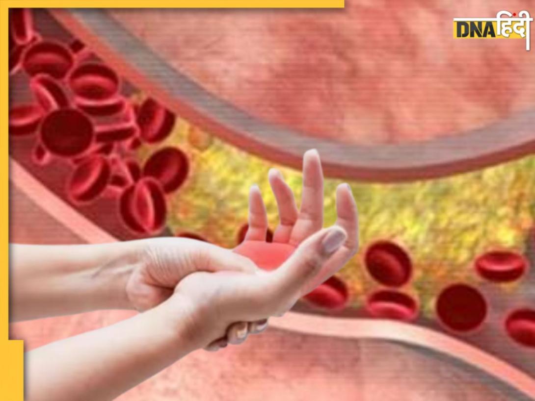 हाथों में नजर आते हैं High Cholesterol के लक्षण, नजर आते ही हो जाइए सावधान!