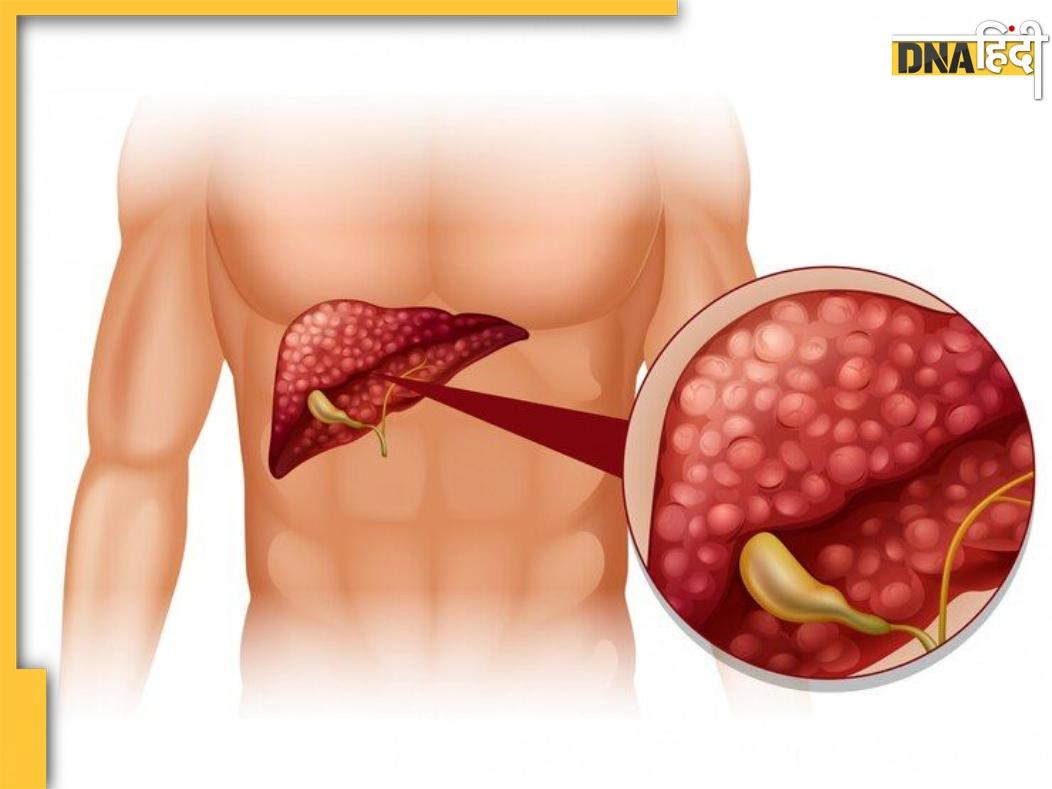 Liver Cancer: शरीर में दिखने वाले ये लक्षण देते हैं लिवर कैंसर का संकेत, तुरंत दें इन बातों पर ध्यान