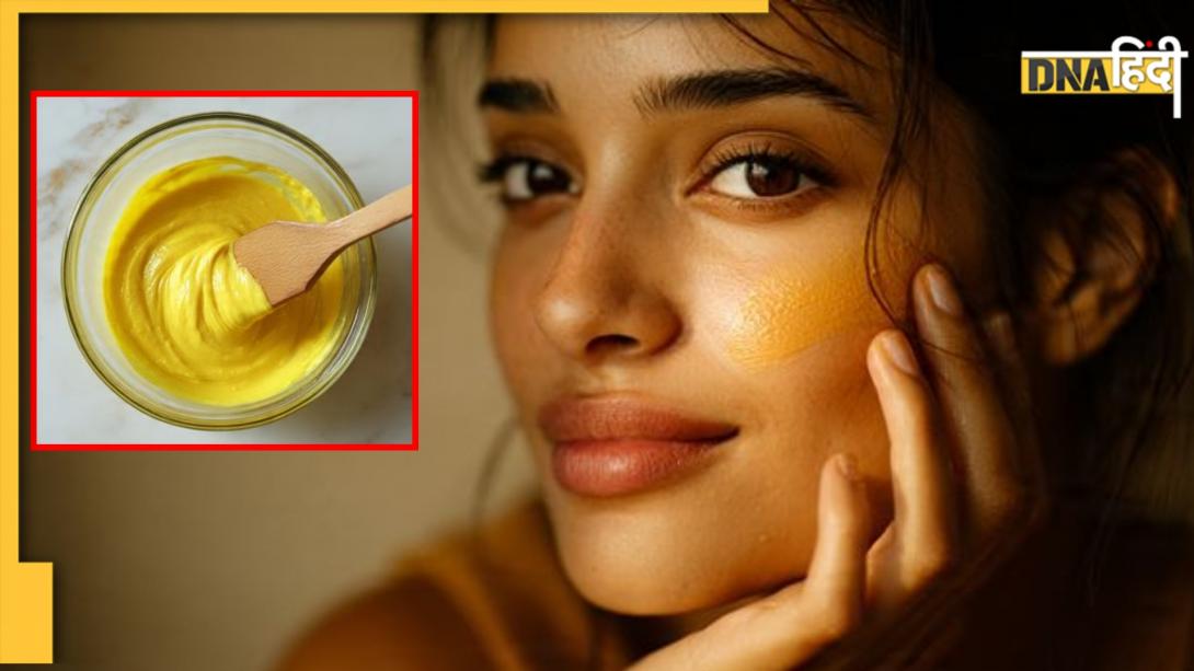 Haldi Gel: पिंपल और दाग-धब्बों से मिलेगा छुटकारा, इस तरह घर पर बना कर लगाएं हल्दी जेल