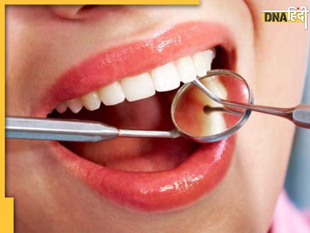 Bad Food For Teeth: आपके दांतों में कैविटी की असली वजह हैं ये फूड्स, आज ही से इन्हें डाइट से कर दें बाहर