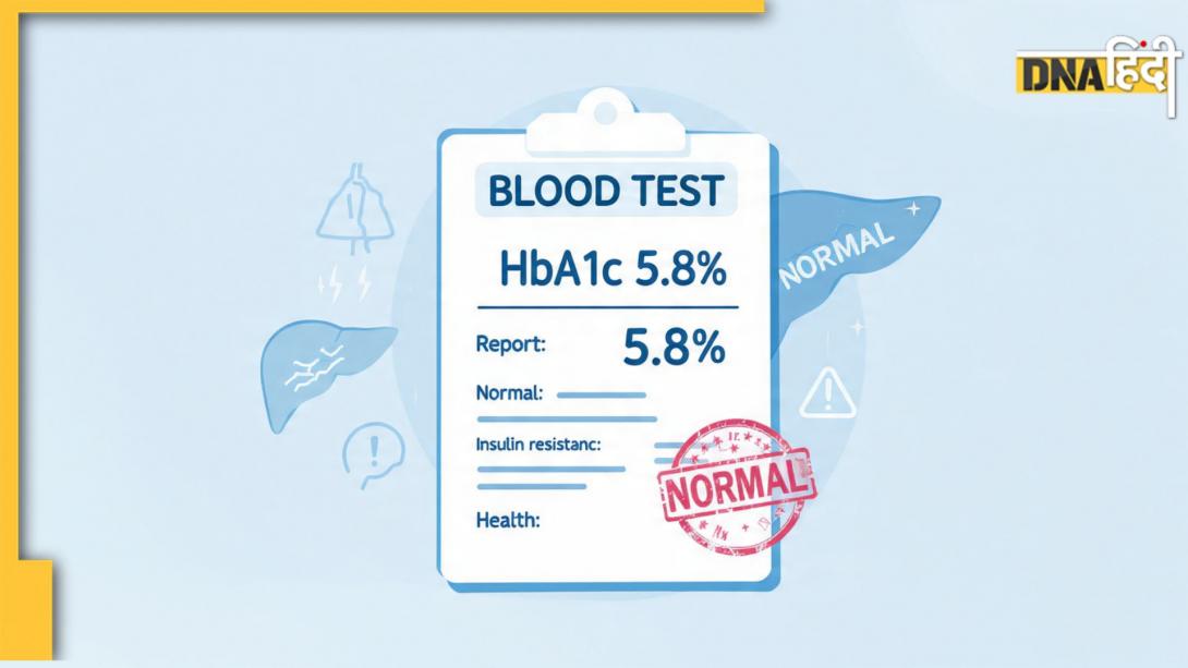 Diabetes Test: सिर्फ HbA1c नहीं! डायबिटीज की जल्दी पहचान के लिए ये टेस्ट भी हैं जरूरी