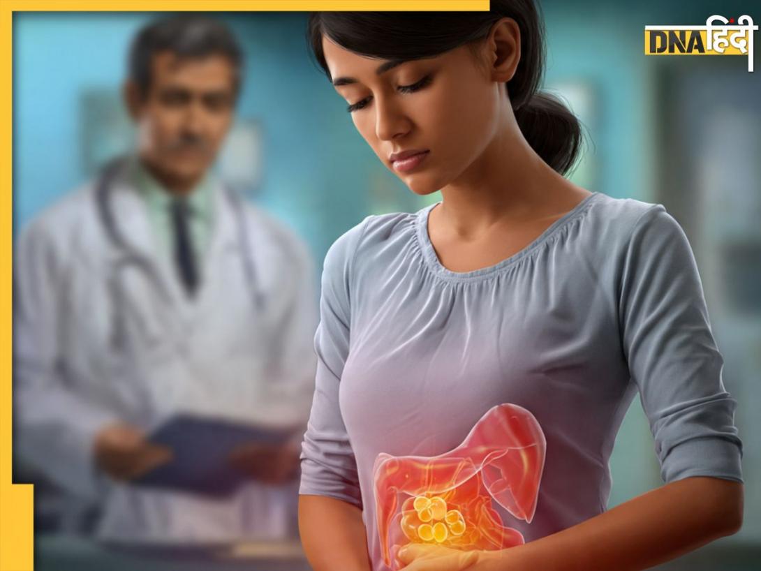 Gallbladder Stones: पित्त की पथरी में एकमात्र ऑप्शन है गॉलब्लैडर निकालना? जानिए क्या हैं दूसरे विकल्प