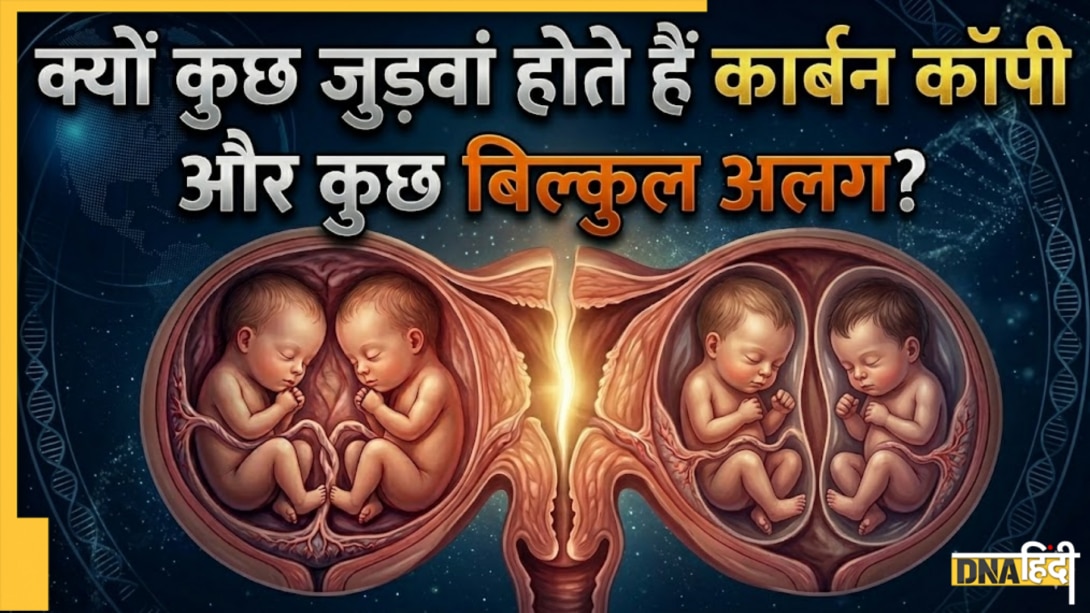 कैसे पैदा होते हैं जुड़वां बच्चे? कभी एक-दूसरे की कार्बन कॉपी तो कभी क्यों नहीं मिलतीं शक्लें, समझें ट्विन्स का पूरा साइंस