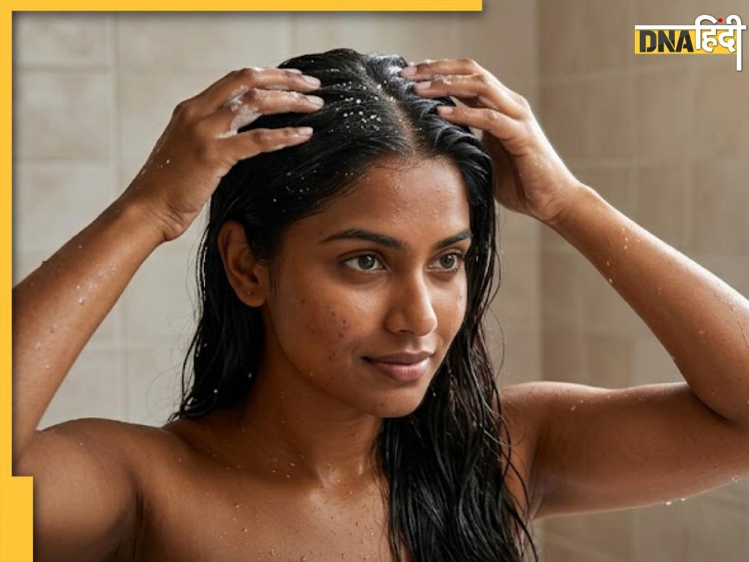  शैंपू में चीनी मिलाकर लगाने से वाकई खत्म हो जाते हैं डैंड्रफ? जानें कैसे काम करता है ये तरीका