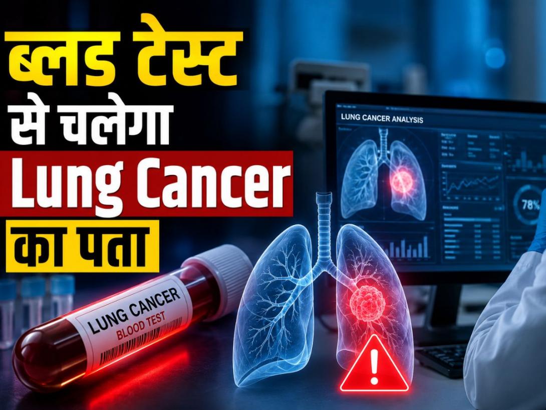 Lung Cancer Detection में बड़ा ब्रेकथ्रू, ब्लड टेस्ट से 5 साल पहले ही चल जाएगा फेफड़ों के कैंसर का पता